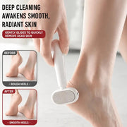 Dual‐Sided Foot Callus Remover thumbnail 4